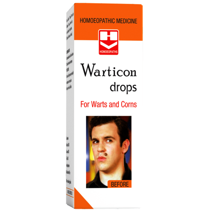 Homeopaths Warticon Drop (30ml Each)